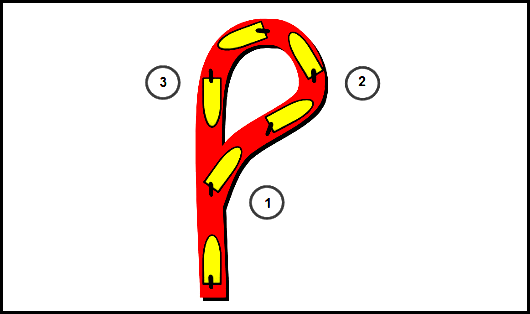 Turn your rudder hard over in one direction &##x28;position 1&##x29;. Watch the steering compass. As soon as you reach 60 degrees of change from your present course, shift your rudder hard over to the opposite si